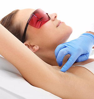 Laser Hair Removal